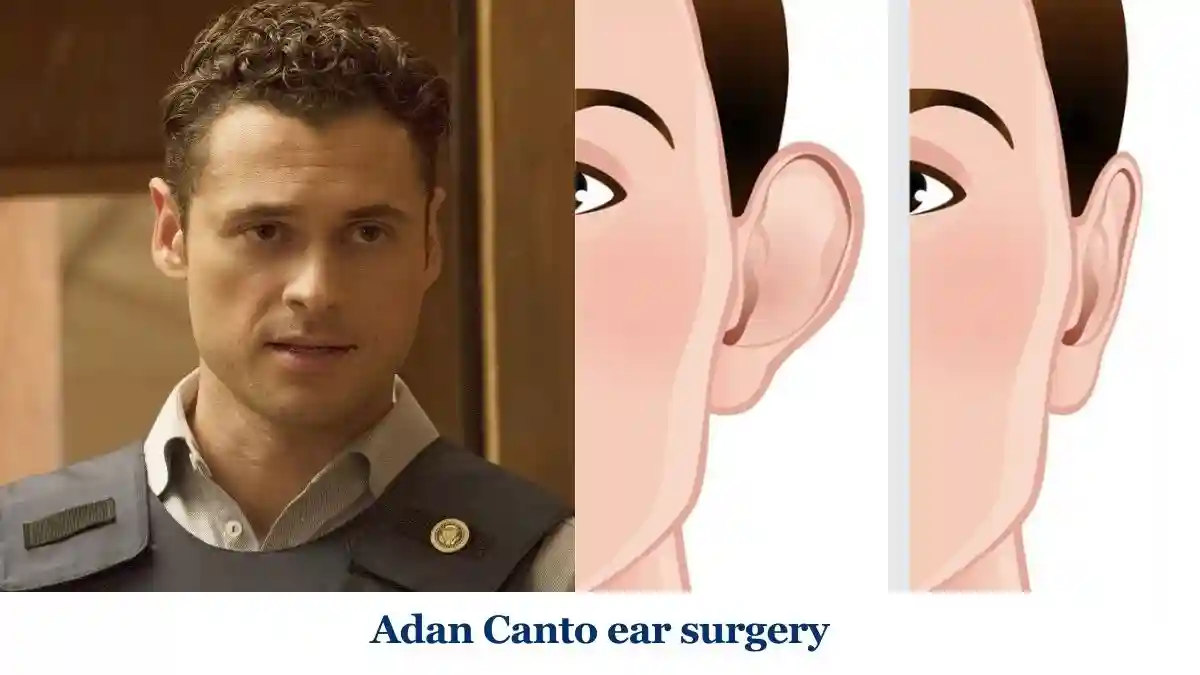 Adan Canto ear surgery